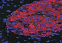 IHC-plus™ Polyclonal Goat anti-Human UNC5H3 / UNC5C Antibody (aa812-823, IHC, IF)