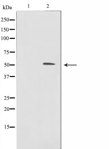 ZNF436 Antibody