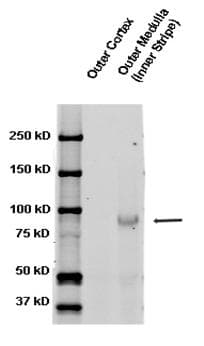 SCNN1B / ENaC Beta Antibody (aa617-638, FITC)