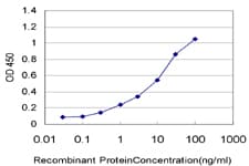 PKD2 / Polycystin 2 Antibody (clone 4C8)