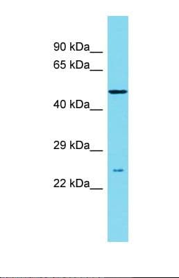 DCC1 / DSCC1 Antibody (aa143-192)