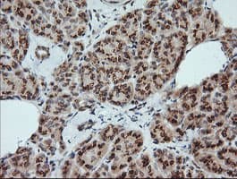 KLK8 / Kallikrein 8 Antibody (clone OTI2C6)