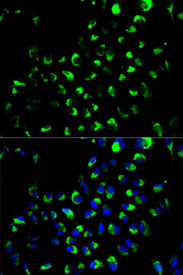 Polyclonal Rabbit anti-Human AK4 / Adenylate Kinase 4 Antibody (IHC, IF, WB)