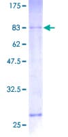 Human SRRT / ARS2 Protein (Recombinant GST)