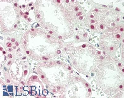 IHC-plus™ NR3C1/Glucocorticoid Receptor Antibody (aa171-220)