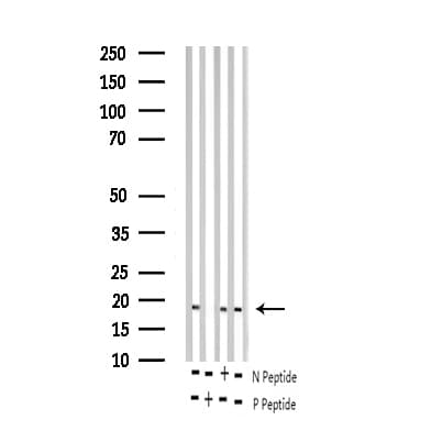 Polyclonal Rabbit anti-Human STMN1 / Stathmin / LAG Antibody (phospho-Ser15, IHC, IF, WB)