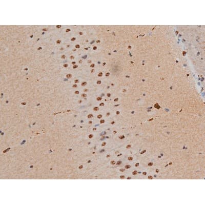 AP-1 / JUND Antibody (phospho-Ser255)
