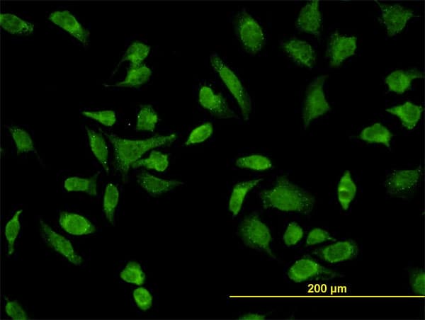 IHC-plus™ Monoclonal Mouse anti-Human SH3BP5 / SAB Antibody (clone 2B3, IHC, IF, WB)