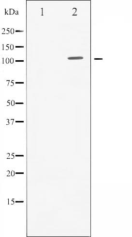 AR / Androgen Receptor Antibody
