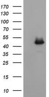 Monoclonal Mouse anti-Human CATIP / C2orf62 Antibody (clone OTI4A12, Carrier-free, IF, WB)