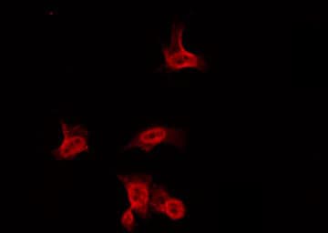 Sodium Channel Antibody