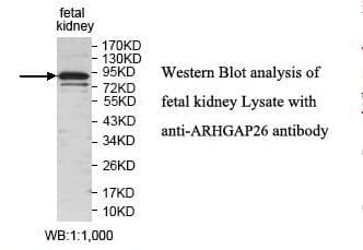 ARHGAP26 / GRAF Antibody (aa377-550)