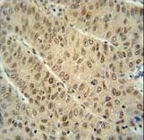 DCAF10 Antibody (aa113-142)