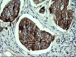 CDH3 / P-Cadherin Antibody (clone 2D5, Carrier-free)
