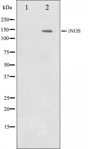 Polyclonal Rabbit anti-Human NOS2 / iNOS Antibody (IHC, IF, WB)