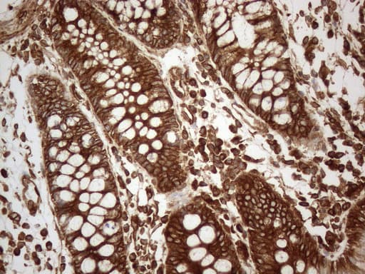 VAP33 / VAPA Antibody (aa2-227, clone OTI10E10)