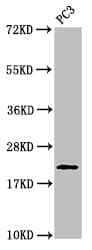 Polyclonal Rabbit anti-Human HIST1H1E Antibody (phospho-Thr146, WB)