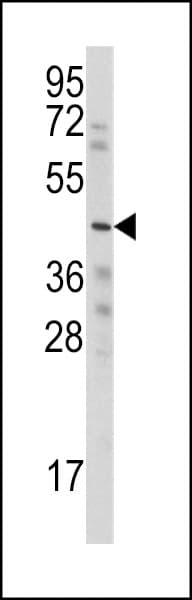 WISP3 Antibody (aa305-335)