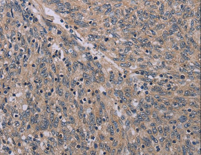 ACVR2 / ACVR2A Antibody