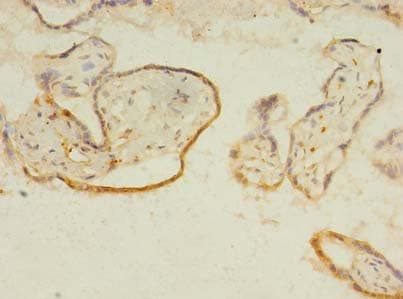 ITIH5 Antibody