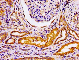 Polyclonal Rabbit anti-Human ADRBK2 / GRK3 Antibody (IHC, WB)