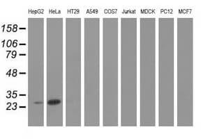 GSTT2 Antibody (clone OTI5A11)