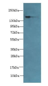 ADAMTS7 Antibody