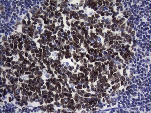 Monoclonal Mouse anti-Human POU2AF1 / BOB1 Antibody (clone UMAB219, IHC)