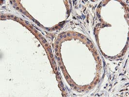 ILVBL Antibody (clone OTI8B12)