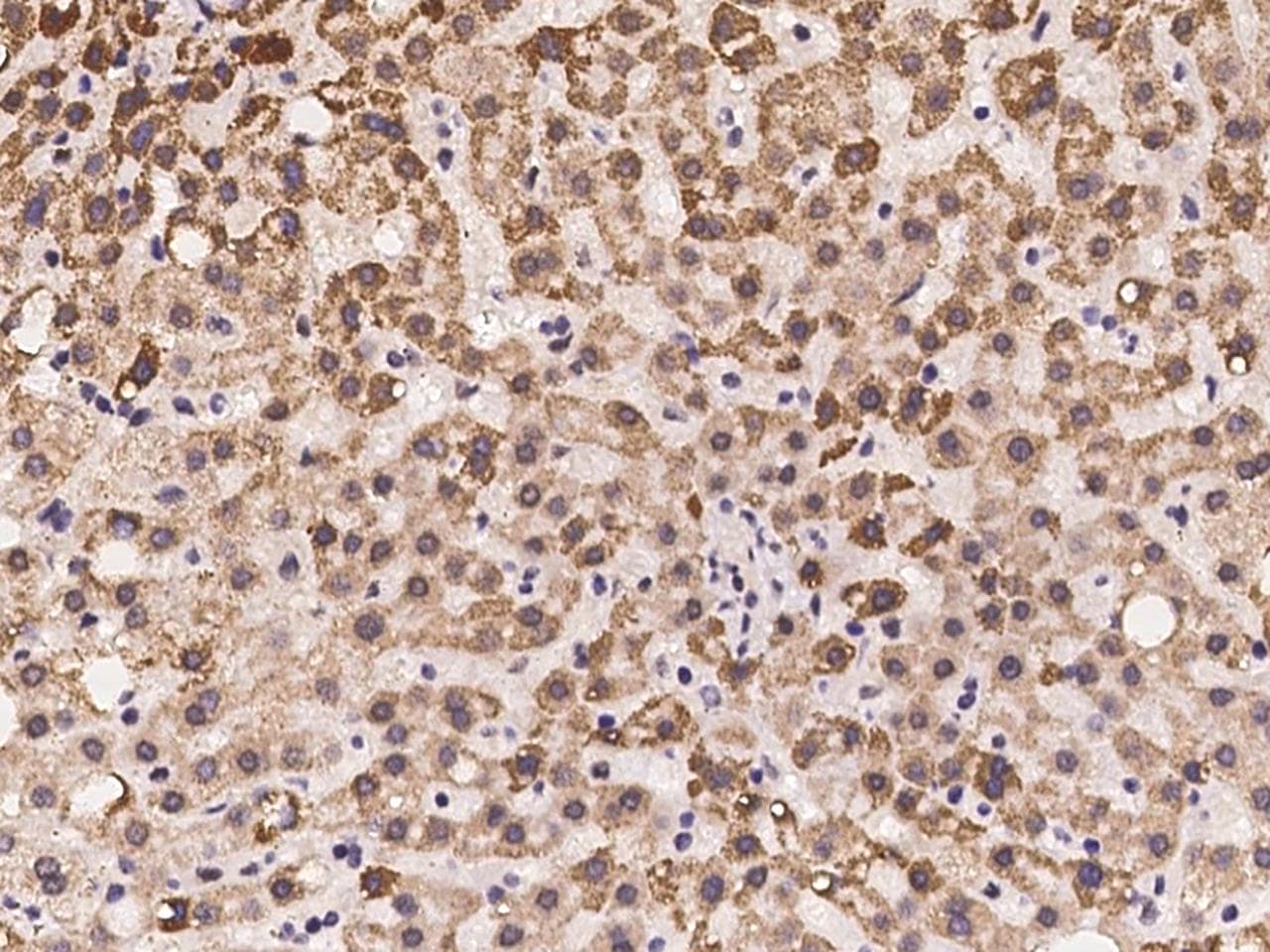 Polyclonal Rabbit anti-Human MMAA Antibody (IHC)
