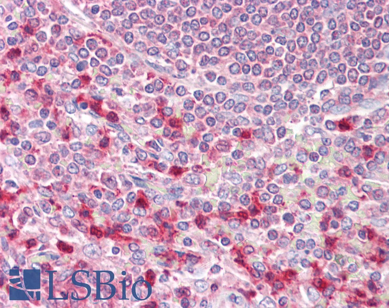 IHC-plus™ EIF4B Antibody (aa570-630)