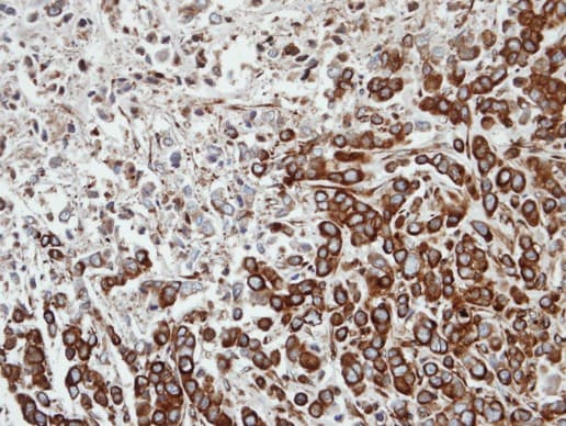 FPGT Antibody (aa146-453)