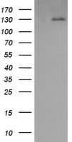 PDGFRB / PDGFR Beta Antibody (clone OTI3B5)