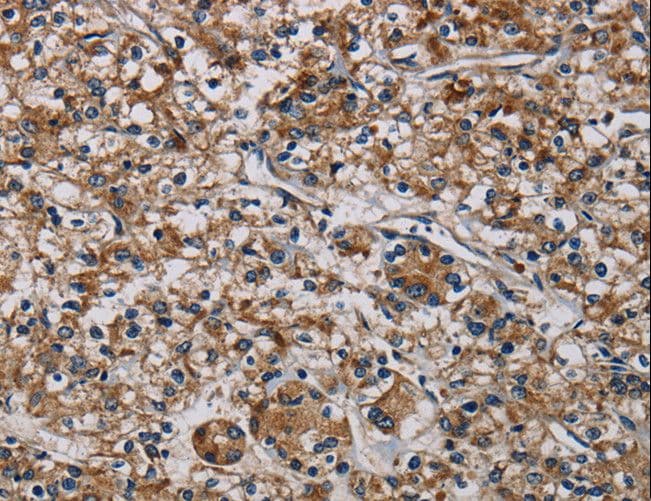 Polyclonal Rabbit anti-Human PLIN3 / M6PRBP1 / TIP47 Antibody (IHC)