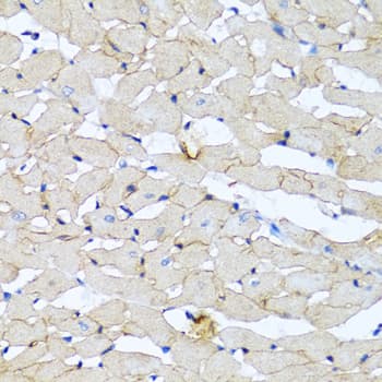 Polyclonal Rabbit anti-Human PTEN Antibody (IHC, WB)