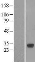 DNAJC27 Protein (Over-Expression Lysate Myc-DDK (Flag))
