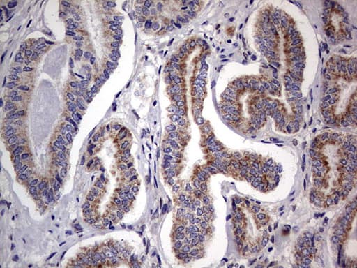 PRX-1 / PRRX1 Antibody (clone OTI1E10)