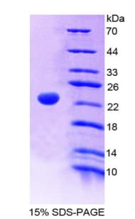 Rat GCG / Glucagon Protein (Recombinant His, N-Terminal)