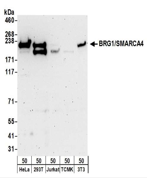 PathPlus™ SMARCA4 / BRG1 Antibody (aa75-125)