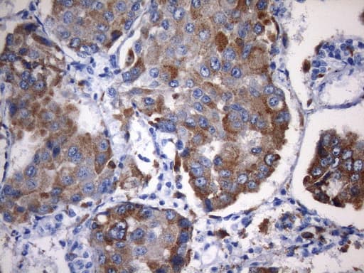 NAPSA / NAPA / Napsin A Antibody (aa64-244, clone UMAB213)