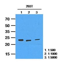 HPRT1 / HPRT Antibody (clone AT2G8)