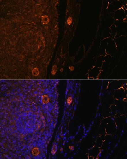 ZP3 Antibody