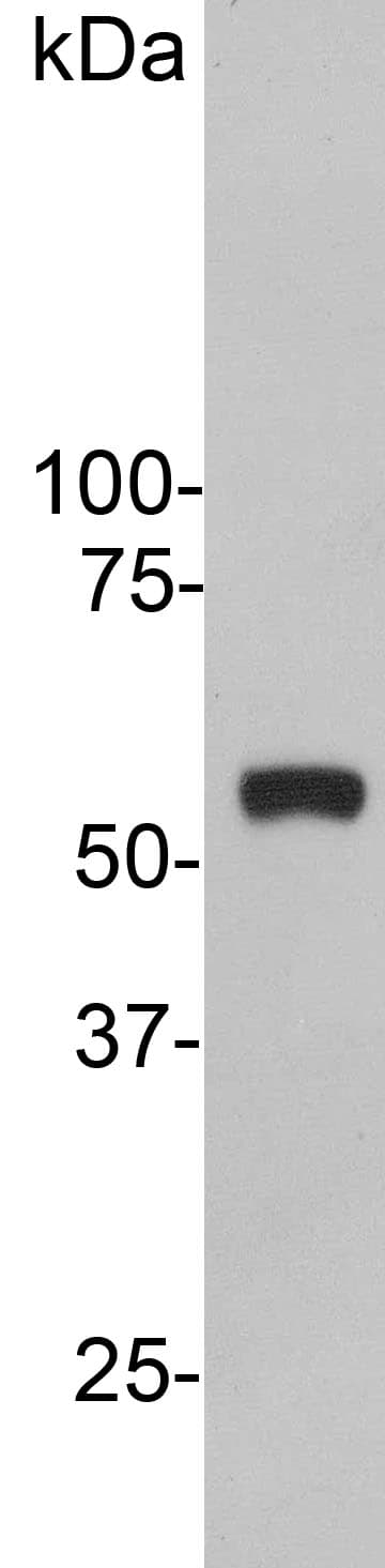 Vimentin Antibody