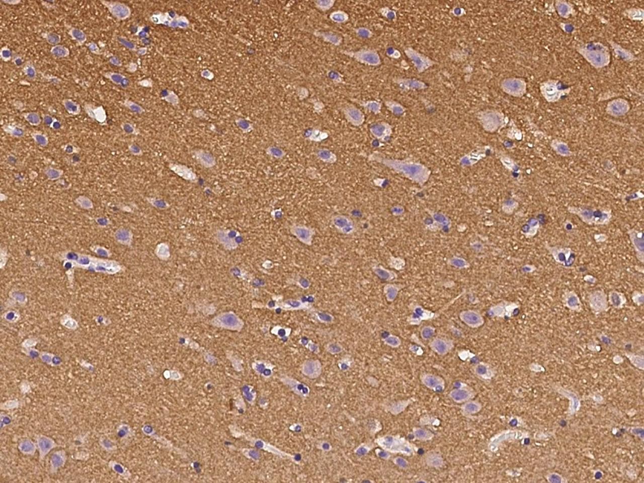 Polyclonal Rabbit anti-Human EPHA4 / EPH Receptor A4 Antibody (Preservative Free, IHC)