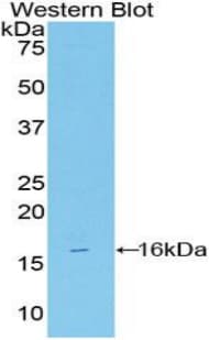 VIP Antibody (aa29-165)