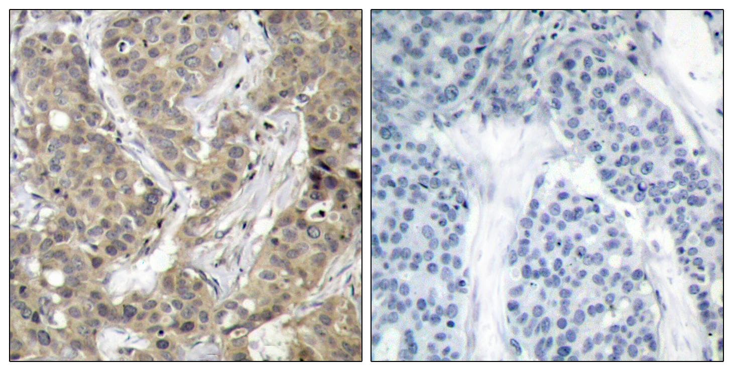 CTNNB1 / Beta Catenin Antibody (p37)