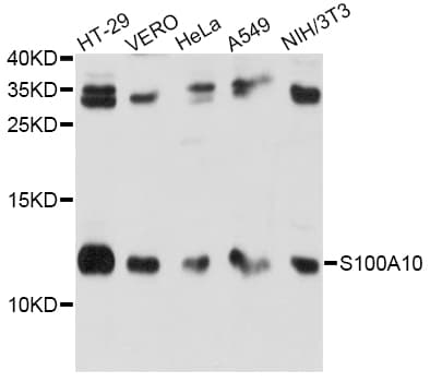 Polyclonal Rabbit anti-Human S100A10 Antibody (IHC, WB)