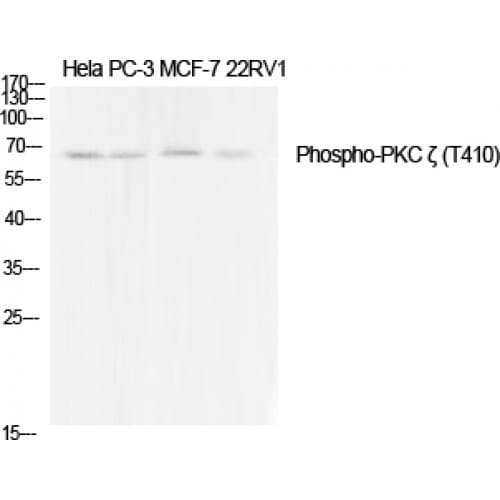 PRKCZ / PKC-Zeta Antibody (350-430 aa)