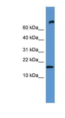Polyclonal Rabbit anti-Mouse FGF1 / Acidic FGF Antibody (N-Terminus, WB)