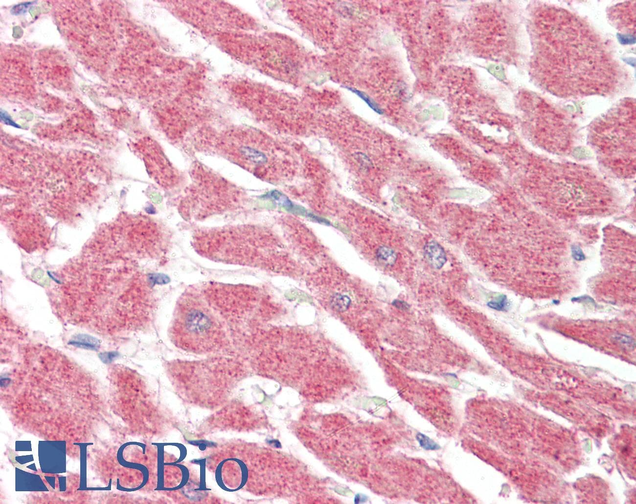 IHC-plus™ LGI4 Antibody